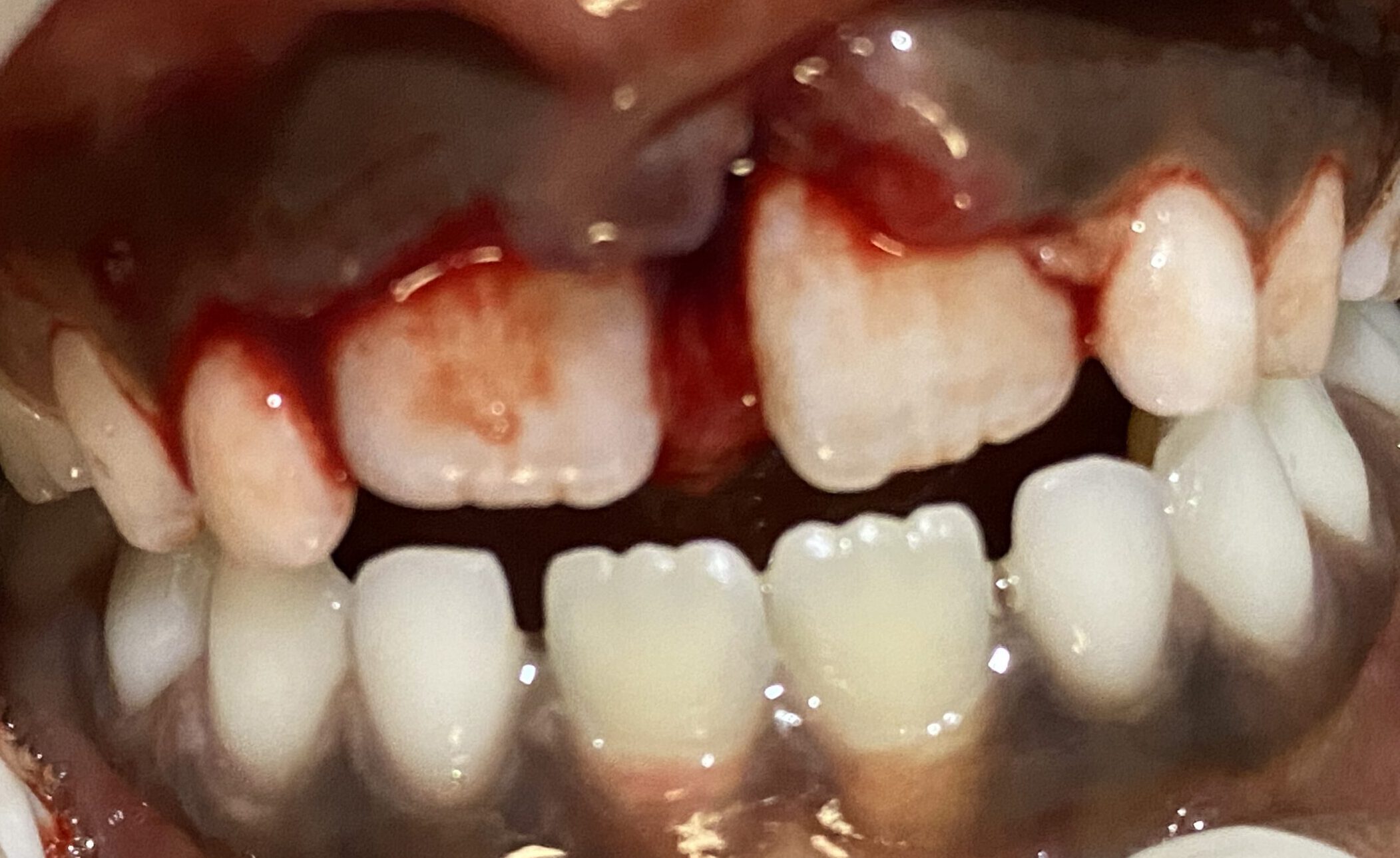 An image of dental trauma