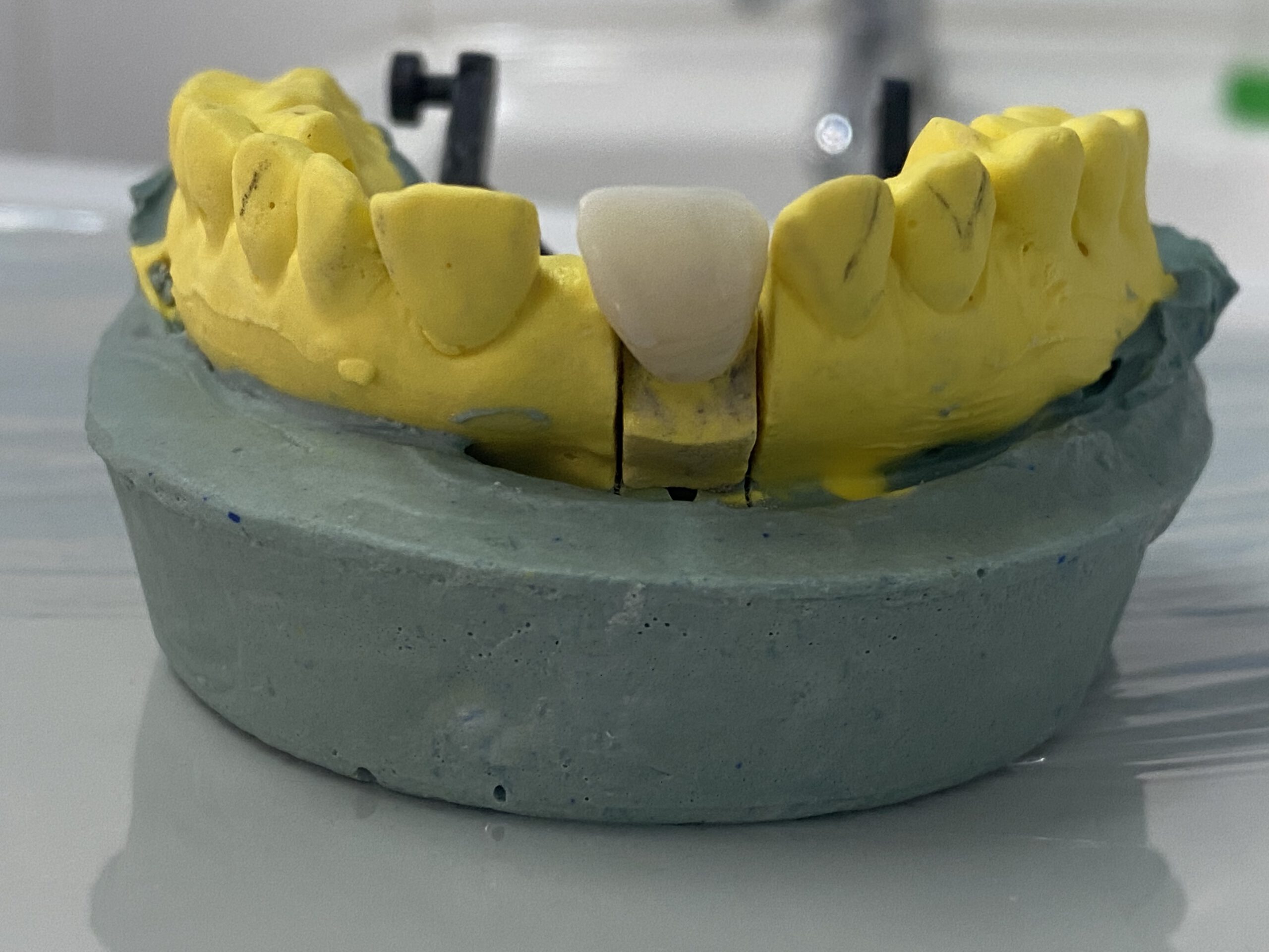 An image of a dental crown