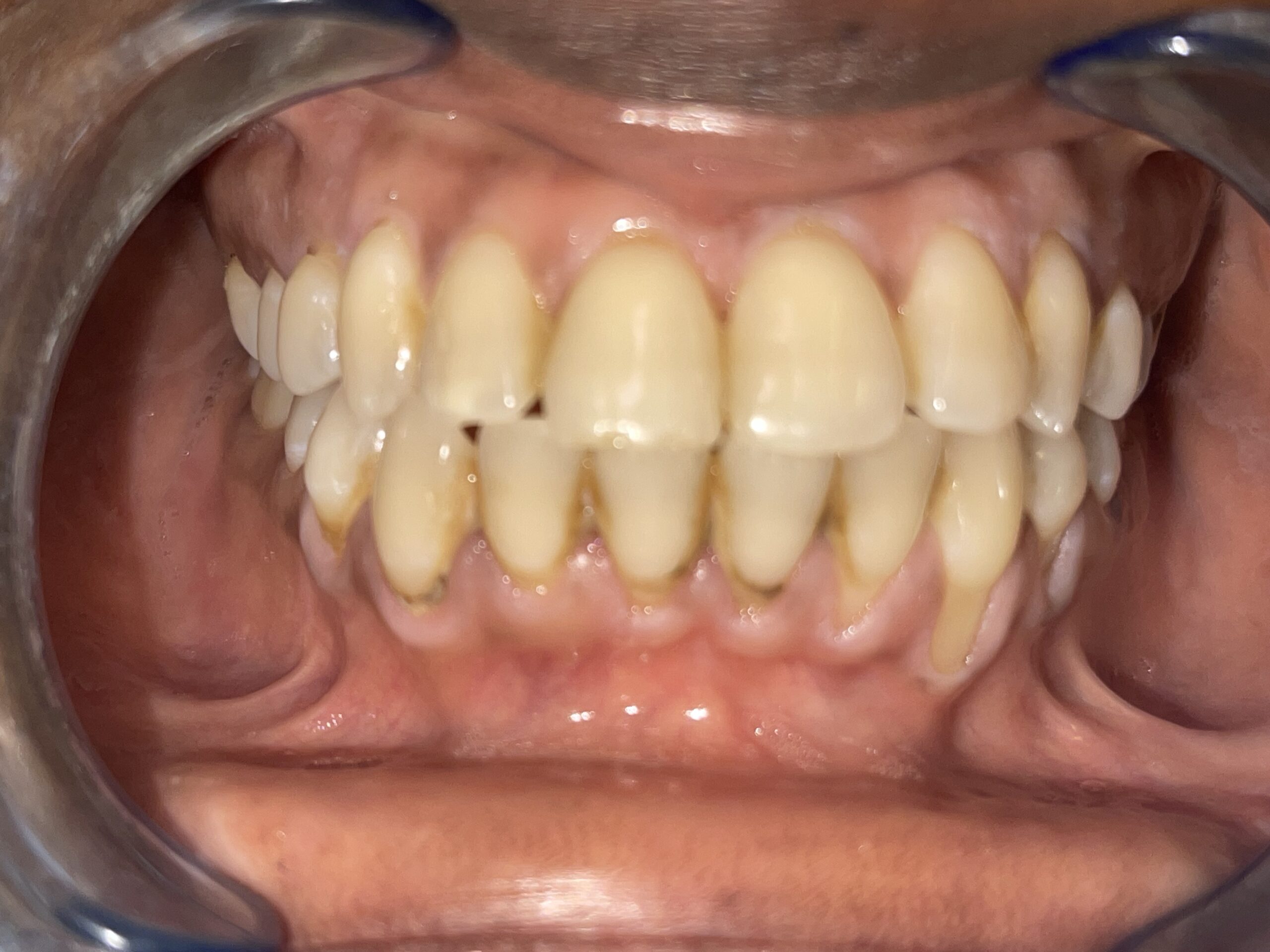 An image of yellow teeth