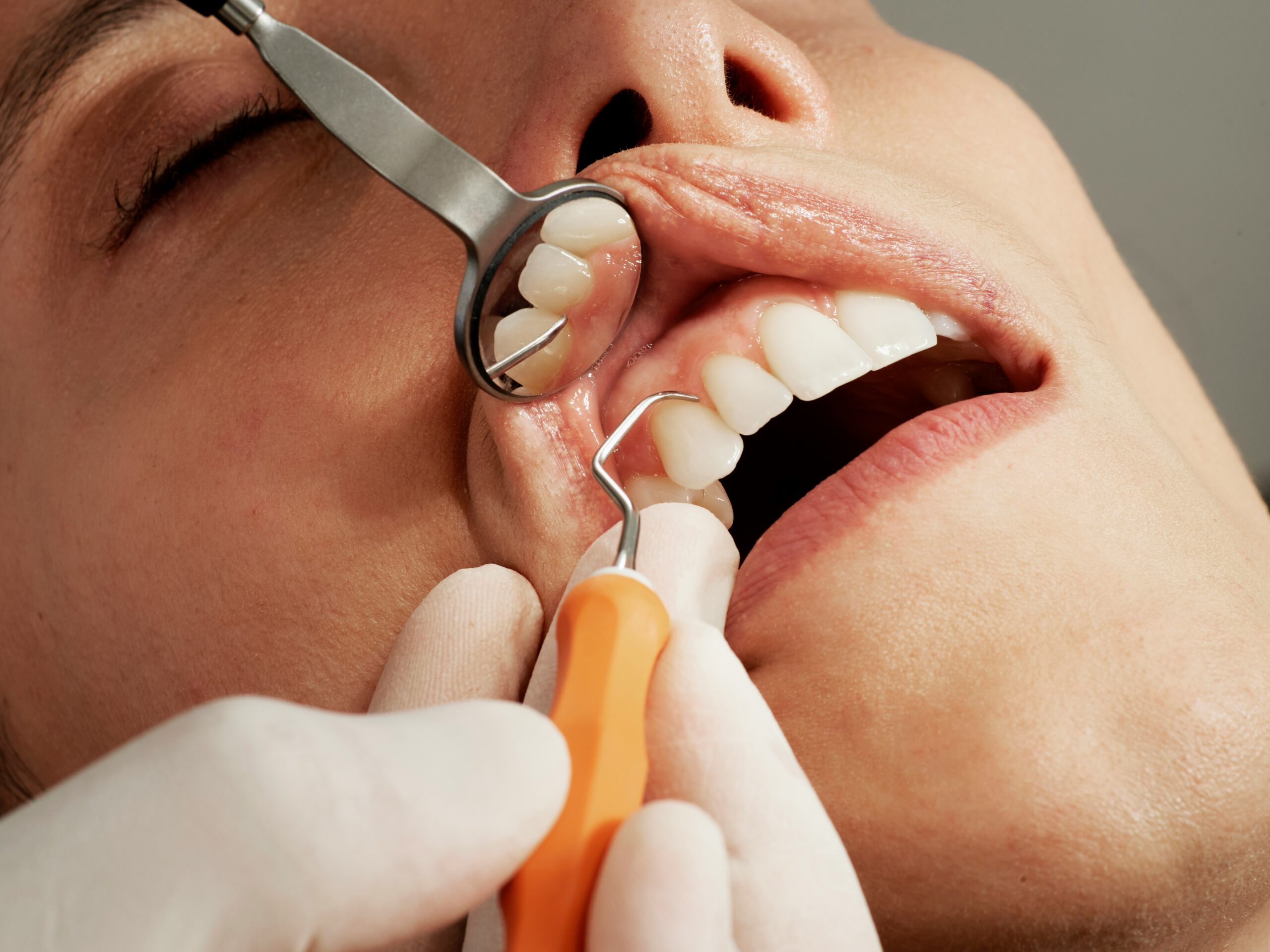 Dental patient undergoing an examintion