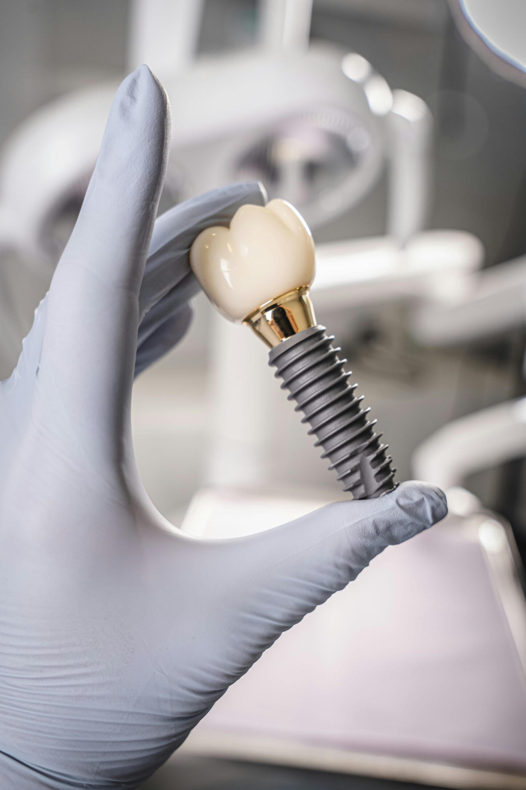 A dental implant