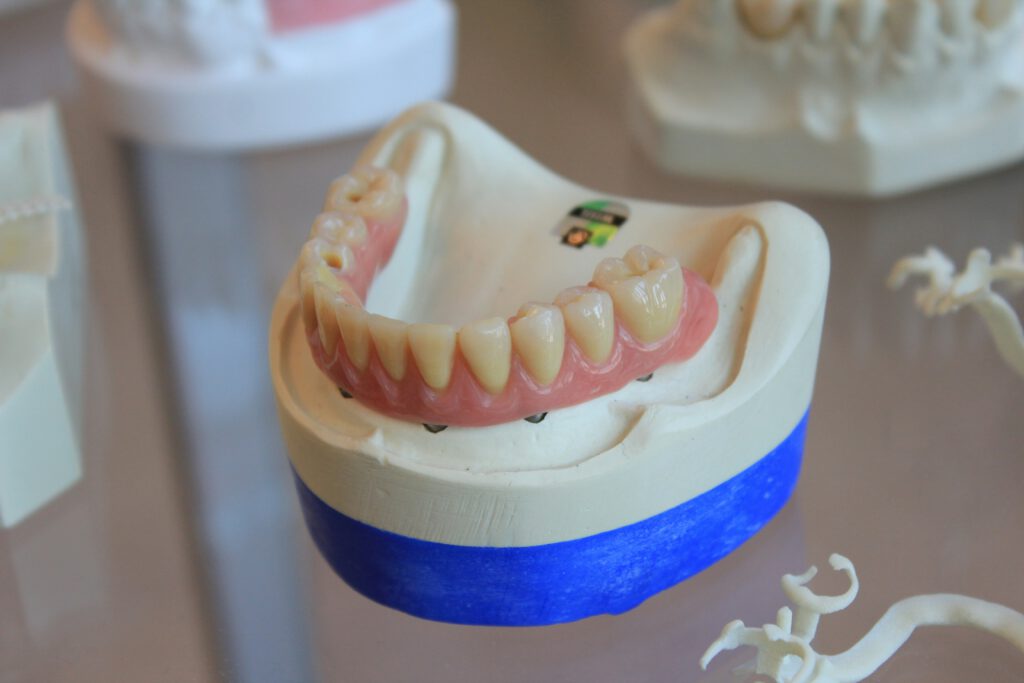An denture